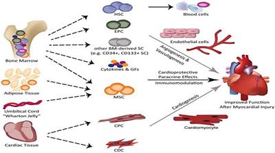 New treatment methods for myocardial infarction